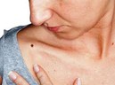 Nốt ruồi trên cơ thể: khi nào cần lo lắng? Nốt ruồi trên cơ thể: khi nào cần lo lắng?