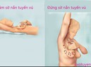 Khi có dấu hiệu sau, 80% là đã mắc ung thư vú Khi có dấu hiệu sau, 80% là đã mắc ung thư vú