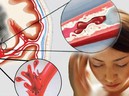 Đang cho con ăn, bà mẹ bất ngờ đột tử: Thủ phạm là căn bệnh cực nguy hiểm - GDN
