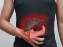 Bác sĩ gan mật chia sẻ 3 cách phát hiện ung thư gan - GDN