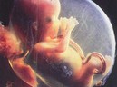 Siêu âm phát hiện nhau thai có chấm đen bí ẩn, bác sĩ cảnh báo mẹ bầu nên cẩn thận với điều này - GDN