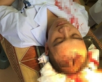 Hà Nội: Bác sĩ bị người nhà bệnh nhân hành hung, máu đổ trên bệnh án