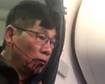Một bác sĩ gốc Á bị lôi kéo, đánh bầm dập trên máy bay
