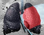 5 thực phẩm được ví là máy hút bụi cho phổi: Thường xuyên ăn, phổi sẽ được dọn sạch sẽ