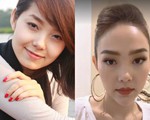 Phía sau chiếc cằm nhọn hoắt của mỹ nhân showbiz là... lòng tham vô đáy?