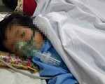 Bé gái 2 tuổi bị chấn thương sọ não sau khi đến lớp học