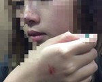 Hà Nội: Xin số điện thoại không được, nữ sinh bị kẻ lạ mặt sàm sỡ ngay trong thang máy chung cư