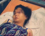Vụ bà bầu bị tra tấn sinh non, thai nhi tử vong: Rùng rợn màn tra tấn bằng keo nấu chảy