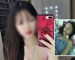 Cô gái xinh đẹp bị rạch mặt ở Bắc Ninh do mâu thuẫn chuyển phòng