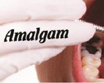 Amalgam – loại chất công ty Rạng Đông sử dụng thay thế thủy ngân thực chất là gì và có nguy hại không?