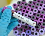 Chuyên gia lý giải vì sao có những bệnh nhân xét nghiệm âm tính rồi lại dương với SARS-CoV-2