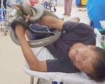 Bệnh nhân bị rắn hổ mang cắn đã qua cơn nguy kịch