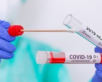 Người đầu tiên tái nhiễm Covid-19 sau hơn 4 tháng khỏi