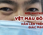 Ở nơi những vệt máu đỏ hằn lên giác mạc