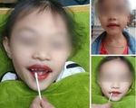 Từ vụ bé 5 tuổi xăm môi, chuyên gia cảnh báo những hệ lụy khó lường tuyệt đối không nên chủ quan!