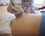 Bất ngờ có thai ở tuổi 50, nữ bệnh nhân đã phải cắt bỏ tử cung để tránh biến chứng do chửa trứng