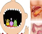 2 loại vi khuẩn trong miệng có thể là &quot;động lực&quot; của ung thư đại trực tràng và ung thư tuyến tụy, người bị bệnh nha chu càng cần chú ý