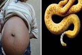 Kinh sợ rắn chui vào, sinh sống trong bụng người Kinh sợ rắn chui vào, sinh sống trong bụng người