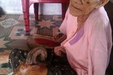 Giải mã hiện tượng người... mọc sừng Giải mã hiện tượng người... mọc sừng