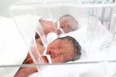 Ngắm 4 thiên thần trong ca sinh tư hi hữu tại Hà Nội Ngắm 4 thiên thần trong ca sinh tư hi hữu tại Hà Nội
