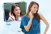 Làm mờ sẹo lồi không khó như bạn nghĩ Làm mờ sẹo lồi không khó như bạn nghĩ