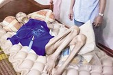 Xót xa gia cảnh người đàn bà hai lần chết lâm sàng Xót xa gia cảnh người đàn bà hai lần chết lâm sàng