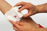 Bị rắn cắn không được ga rô? Bị rắn cắn không được ga rô?