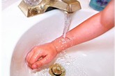 Cách đơn giản giúp bé ứng phó với vết bỏng Cách đơn giản giúp bé ứng phó với vết bỏng
