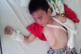 Đánh con riêng “vợ hờ” đến nứt sọ ở TP Hồ Chí Minh: Đổ lỗi cho… rượu Đánh con riêng “vợ hờ” đến nứt sọ ở TP Hồ Chí Minh: Đổ lỗi cho… rượu