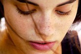 Rối loạn nội tiết gây nám da Rối loạn nội tiết gây nám da