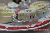 Bọc Răng Sứ Thẩm Mỹ Tại Nha Khoa Đông Nam Bọc Răng Sứ Thẩm Mỹ Tại Nha Khoa Đông Nam