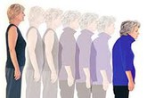 Phụ nữ có thể “lùn” đi 5cm khi về già Phụ nữ có thể “lùn” đi 5cm khi về già