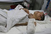Thai phụ bị ôtô kéo lê có thể bị hoại tử hai chân Thai phụ bị ôtô kéo lê có thể bị hoại tử hai chân