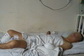 Bị “nướng chín” chân tay do làm nhà cạnh đường điện Bị “nướng chín” chân tay do làm nhà cạnh đường điện
