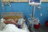 Hoại tử cánh tay do bị mèo cắn Hoại tử cánh tay do bị mèo cắn