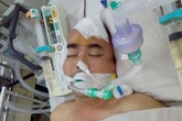 Nguyễn Hoàng vẫn hôn mê sau một tuần phẫu thuật Nguyễn Hoàng vẫn hôn mê sau một tuần phẫu thuật