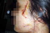 Lật tẩy chiêu trò tung tin nữ sinh bị cướp rạch mặt ở Hà Nội Lật tẩy chiêu trò tung tin nữ sinh bị cướp rạch mặt ở Hà Nội