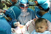 Bé bị đâm xuyên sọ phải phẫu thuật vì nhiễm trùng não Bé bị đâm xuyên sọ phải phẫu thuật vì nhiễm trùng não
