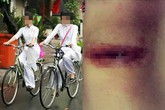 Rạch đùi 18 thiếu nữ, trò biến thái của gã công tử si tình Rạch đùi 18 thiếu nữ, trò biến thái của gã công tử si tình