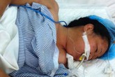 Người phụ nữ bị rắn cắn trong giấc ngủ trưa Người phụ nữ bị rắn cắn trong giấc ngủ trưa