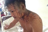 Xông vào nhà tạt axit, rớt 3 ngón tay tại hiện trường Xông vào nhà tạt axit, rớt 3 ngón tay tại hiện trường