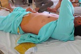 Hai người đàn ông suýt mất ‘của quý’ vì bất cẩn Hai người đàn ông suýt mất ‘của quý’ vì bất cẩn