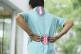 Bài thuốc xương khớp bí truyền, hiệu quả vượt trội điều trị thoái hóa, vôi hóa, gai đôi đốt sống cổ, đốt sống lưng Bài thuốc xương khớp bí truyền, hiệu quả vượt trội điều trị thoái hóa, vôi hóa, gai đôi đốt sống cổ, đốt sống lưng