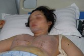 Vợ nâng ngực, chồng không dám sờ vì sợ... nổ! Vợ nâng ngực, chồng không dám sờ vì sợ... nổ!