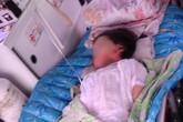 Bé gái bị bỏng nửa người đã nói được chuyện Bé gái bị bỏng nửa người đã nói được chuyện