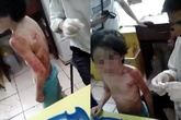 Chấn động bé 6 tuổi bị mẹ đánh thâm tím khắp người Chấn động bé 6 tuổi bị mẹ đánh thâm tím khắp người
