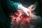 Những hình ảnh lần đầu công bố về ca ghép tạng xuyên Việt Những hình ảnh lần đầu công bố về ca ghép tạng xuyên Việt