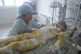 Nước mắt ân hận, day dứt của người mẹ có con 6 tuổi bỏng nặng do nấu cám lợn Nước mắt ân hận, day dứt của người mẹ có con 6 tuổi bỏng nặng do nấu cám lợn