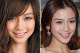 Phim cắt lớp cáo buộc mũi Angelababy có vật thể lạ Phim cắt lớp cáo buộc mũi Angelababy có vật thể lạ