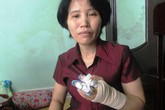 Người phụ nữ cầm dao chém đứt lìa 2 ngón tay hàng xóm Người phụ nữ cầm dao chém đứt lìa 2 ngón tay hàng xóm